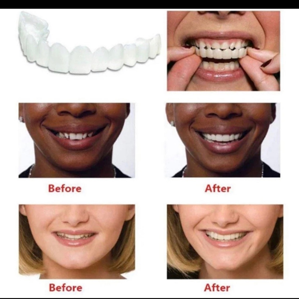 False teeth snap on smile removable reusable temporary new fake teeth - Picture 4 of 7